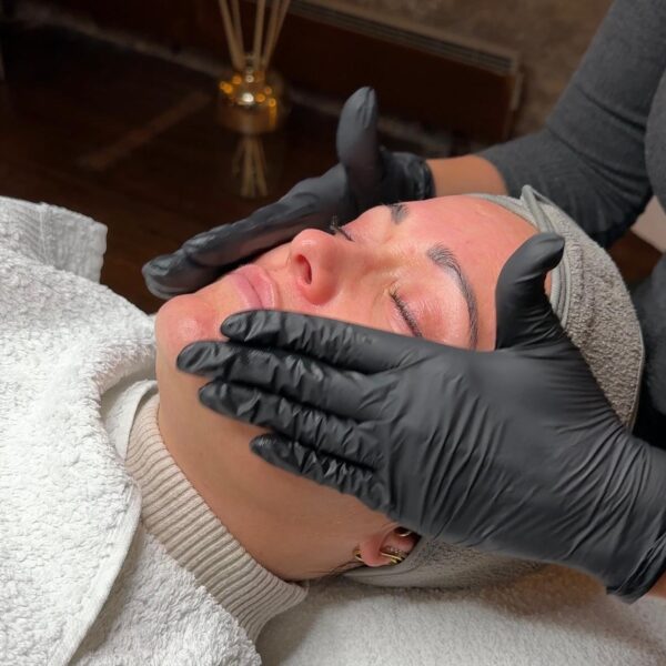 Nicole-Trautmann. Microneedling Radebeul