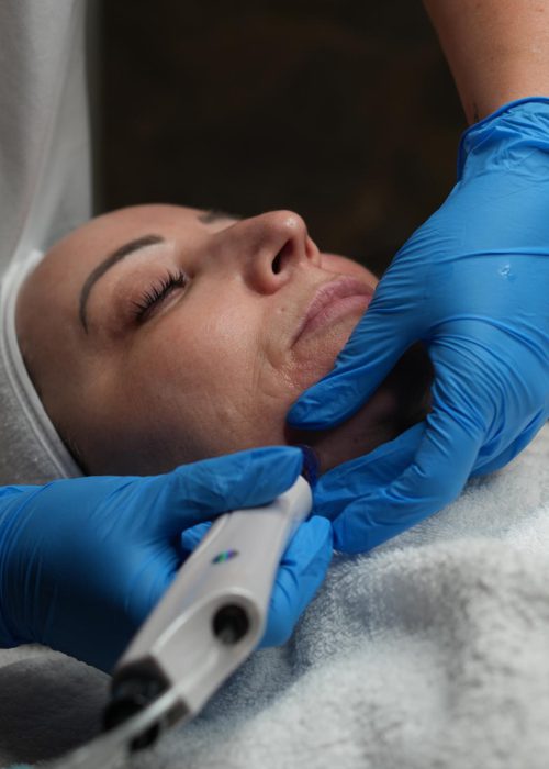 Aqua Facial behandlung Radebeul, Nicole-Trautmann-gerät Aqua Facial behandlung Radebeul, Nicole-Trautmann-gerät