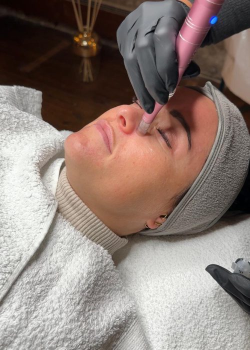 Nicole-Trautmann. Microneedling Radebeul Nicole-Trautmann. Microneedling Radebeul